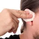 Kyste du lobe de l'oreille causes et traitement