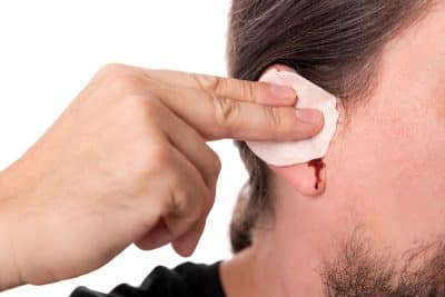 Kyste du lobe de l'oreille causes et traitement