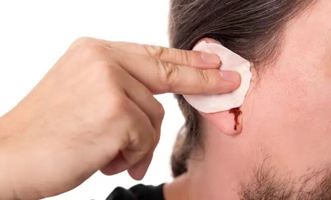 Kyste du lobe de l'oreille causes et traitement